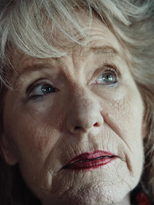 Fine Lines and Wrinkles: What You Should Know