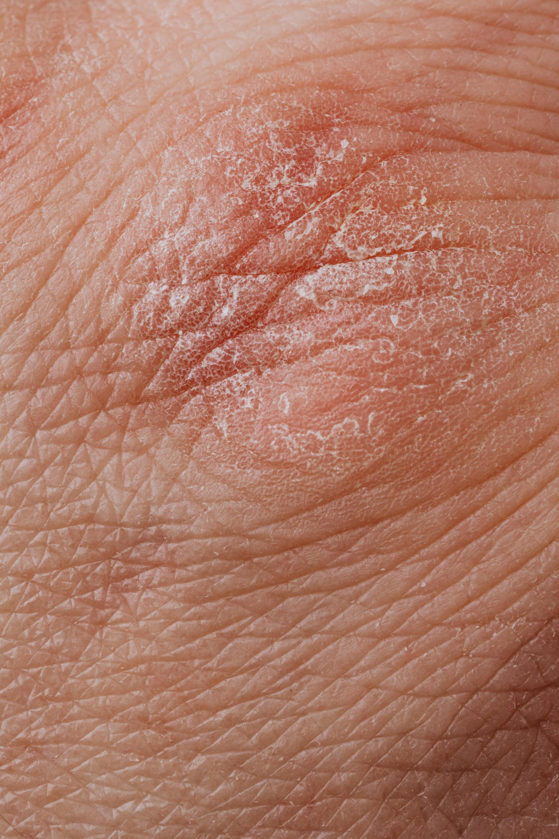 Dry, Itchy Skin? Here's What You Can Do About It!